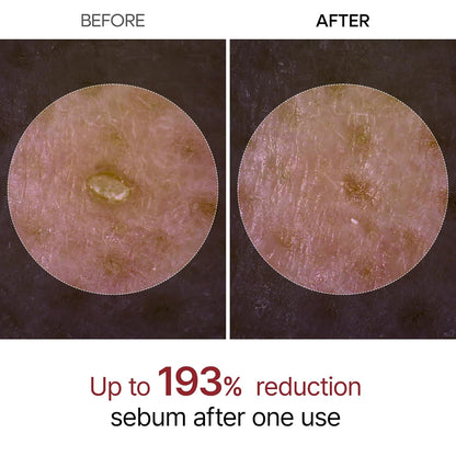 Dr.Melaxin Officiall Peel Shot Glow RiceAmpoule Duo -Serums for BrighteningExfoliating, and Moisturizing - Suitable for All Skin Types